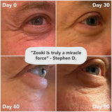 Zooki Collagen Variety Pack 5xMango Peach, 5xCitrus Lime, 4xBerry 5000mg 14x15ml CASE