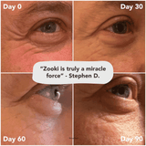 Zooki Collagen Liquid Sachets Mango Peach Flavour Super Strength 11,000mg 14x18.5ml Sachets CASE